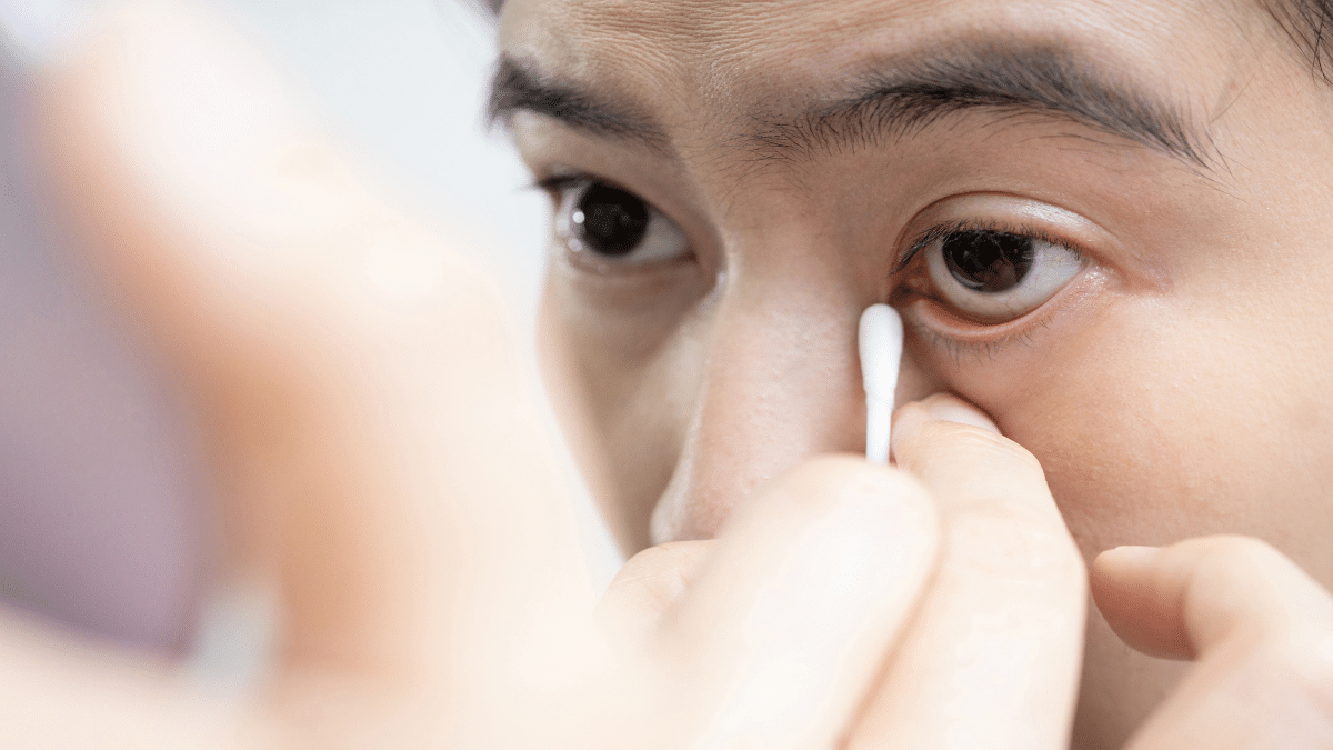 itchy eyes home remedies