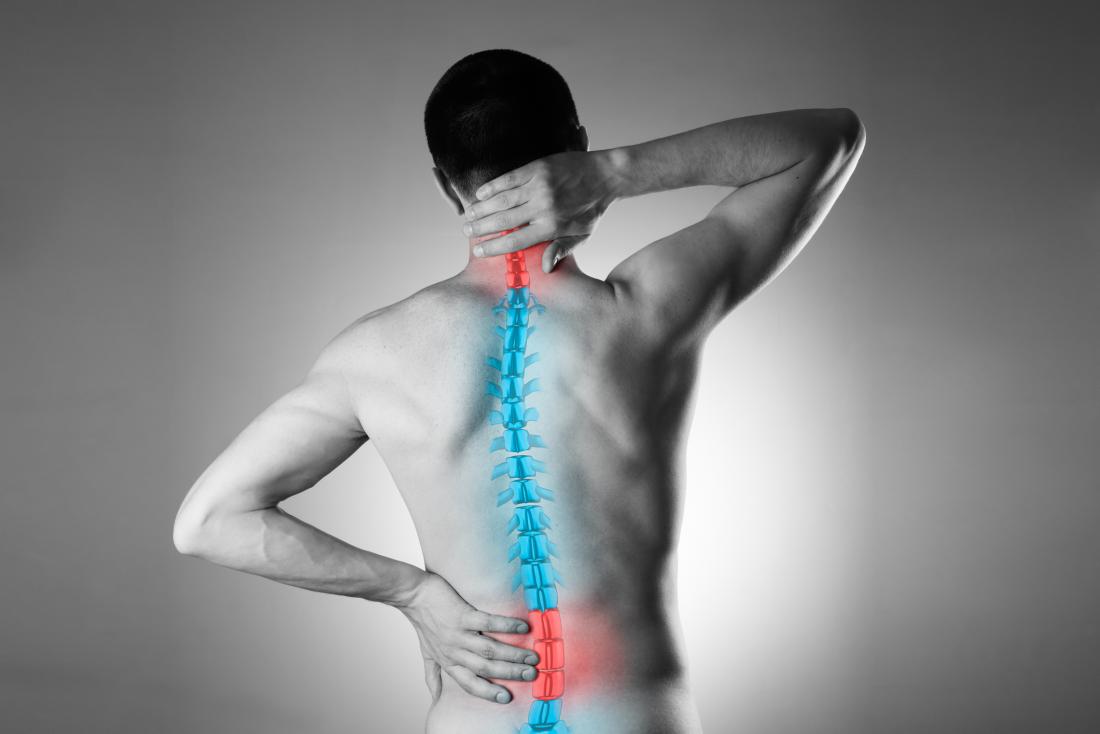 How to relieve the pain from sciatica?