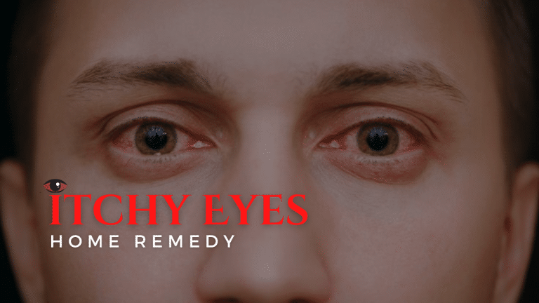 itchy eyes home remedies